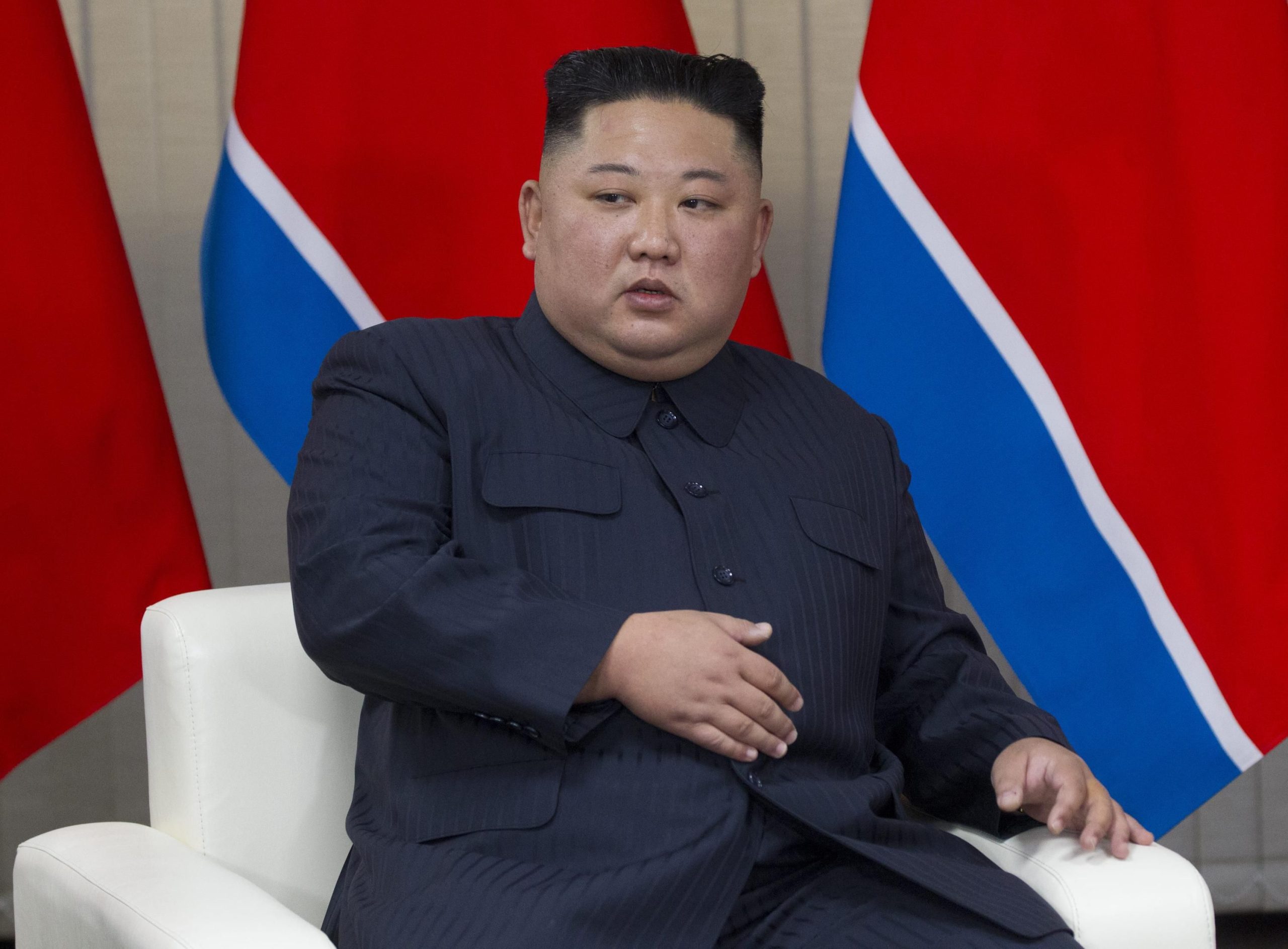 Ким Чен Ын якобы скончался от кровоизлияния в мозг: что известно о слухах